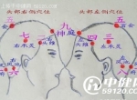 中医养生：巧按头部九宫可治偏头痛