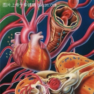 动脉粥样硬化容易与哪些症状混淆？
