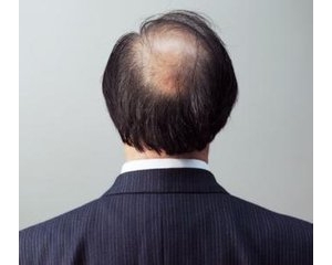 秃顶男性具有四大生理优势