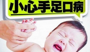 [第634期]手足口病高发 如何预防