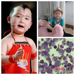 头号杀手白血病 春晚福娃邓鸣贺因该病去世
