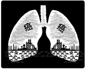 [第683期]肺癌成头号杀手 需警惕！