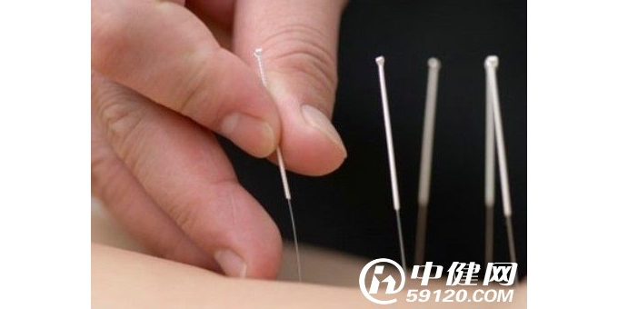 针灸减肥要注意的五大误区