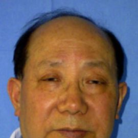 周孝麟（北京同仁长虹医院）