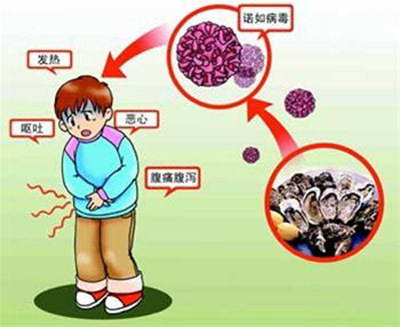 [第1149期]诺如病毒突袭多地幼儿园!怎么防?